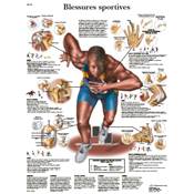 Poster Anatomique Pathologie du sport